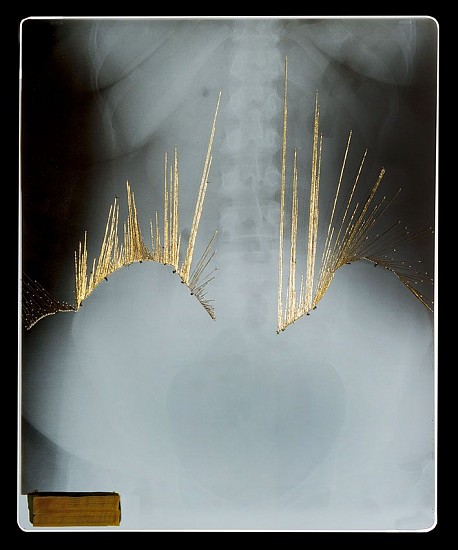 BRONWYN LACE, Silver and Gold I
2015, X-RAY, Gold Thread, Perspex and LED Light