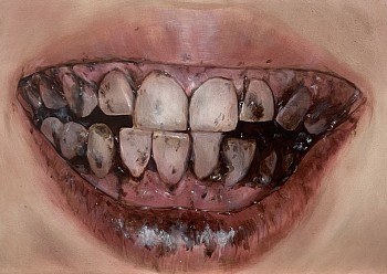 shayna arvan tooth study ii.jpeg